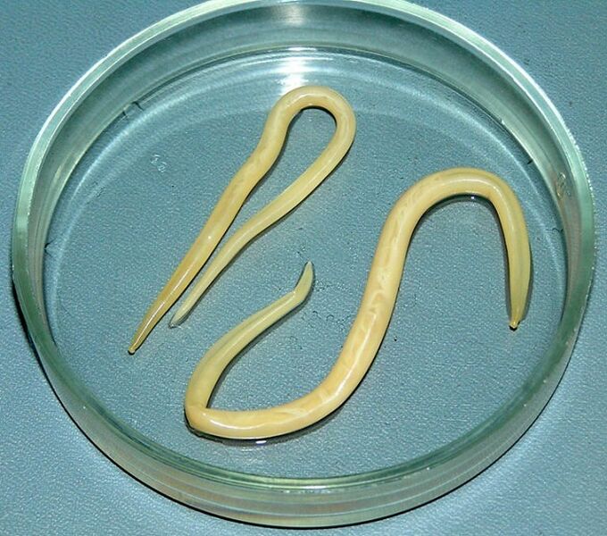 a worm parasite from the human body
