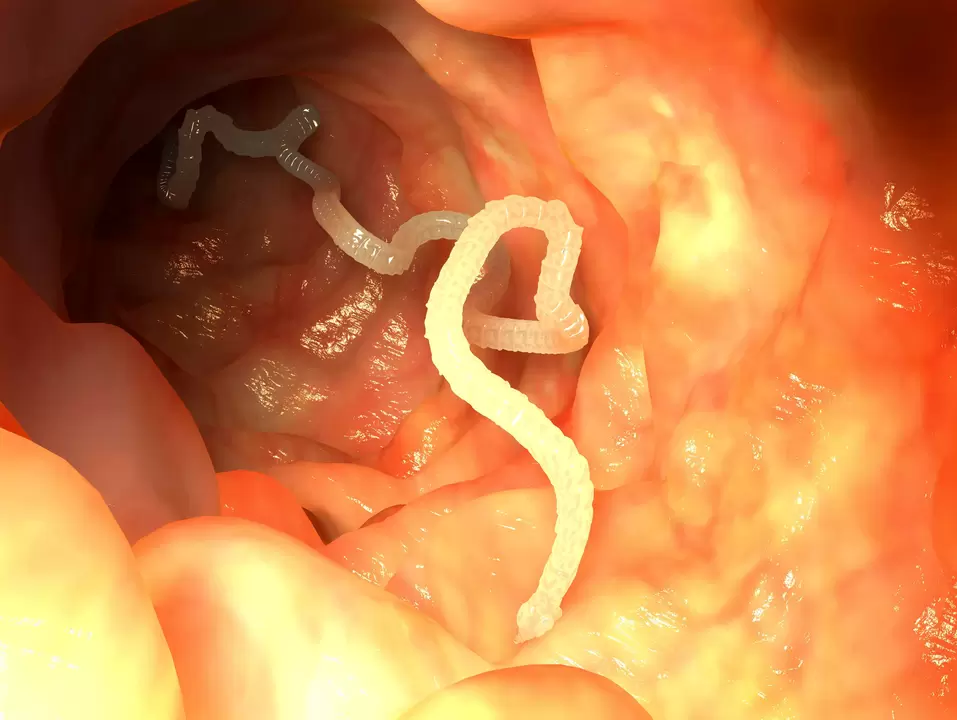 human parasitic esophageal worm