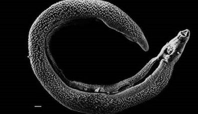 Which parasites can live in a person's liver