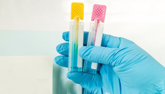 Parasite diagnostics methods